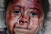 Gazze’de öldürülen çocuk sayısı, son dört yıldaki savaşlarda öldürülen çocuk sayısını aştı